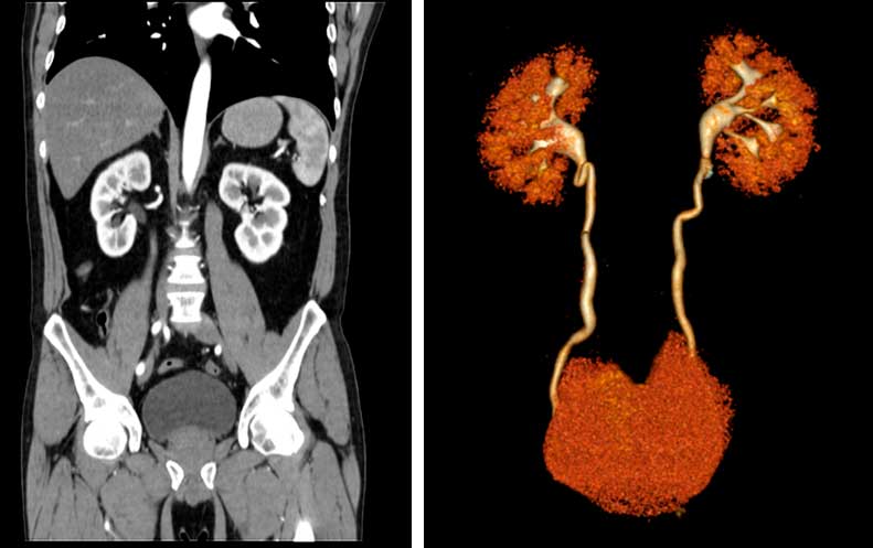 https://verkenlab.com/wp-content/uploads/2020/04/urotomografia-1.jpg